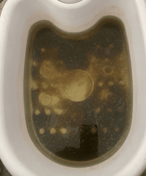 Ionic detox foot spa water after treatment — dark discoloration shows toxins drawn out